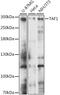 TATA-Box Binding Protein Associated Factor 1 antibody, A15730, ABclonal Technology, Western Blot image 