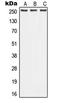 ATP Binding Cassette Subfamily A Member 1 antibody, LS-C353701, Lifespan Biosciences, Western Blot image 