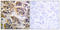 Erb-B2 Receptor Tyrosine Kinase 3 antibody, LS-C117910, Lifespan Biosciences, Immunohistochemistry paraffin image 