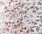 Fragile X Mental Retardation 1 antibody, ab17722, Abcam, Immunohistochemistry paraffin image 