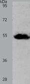 ASCT-1 antibody, TA322915, Origene, Western Blot image 