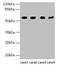Keratin 79 antibody, LS-C394657, Lifespan Biosciences, Western Blot image 