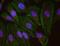 Actin Like 6A antibody, NB100-61628, Novus Biologicals, Proximity Ligation Assay image 