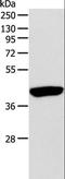 Adenosine Deaminase antibody, LS-C401175, Lifespan Biosciences, Western Blot image 