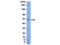 LYN Proto-Oncogene, Src Family Tyrosine Kinase antibody, NBP2-29697, Novus Biologicals, Western Blot image 