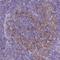 CD40 Molecule antibody, NBP2-33957, Novus Biologicals, Immunohistochemistry paraffin image 