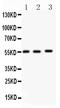 Matrix Metallopeptidase 14 antibody, PB9283, Boster Biological Technology, Western Blot image 