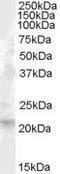 Fibroblast Growth Factor 21 antibody, EB08067, Everest Biotech, Western Blot image 