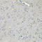 Eukaryotic Translation Initiation Factor 3 Subunit C antibody, 22-638, ProSci, Immunohistochemistry paraffin image 