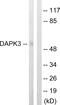 Death Associated Protein Kinase 3 antibody, abx012813, Abbexa, Western Blot image 