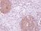 Mitogen-Activated Protein Kinase Kinase Kinase Kinase 5 antibody, NBP1-31234, Novus Biologicals, Immunohistochemistry frozen image 