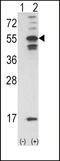 Calcium/Calmodulin Dependent Protein Kinase II Alpha antibody, 62-898, ProSci, Western Blot image 