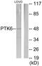 Protein Tyrosine Kinase 6 antibody, LS-C119032, Lifespan Biosciences, Western Blot image 