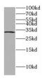 Distal-Less Homeobox 3 antibody, FNab02418, FineTest, Western Blot image 