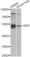 X-Linked Inhibitor Of Apoptosis antibody, A13277, ABclonal Technology, Western Blot image 