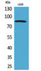 Platelet Derived Growth Factor Receptor Alpha antibody, STJ96630, St John