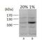 HIF1-alpha antibody, GTX30647, GeneTex, Western Blot image 
