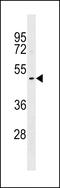 Deoxyribonuclease 1 Like 1 antibody, 60-123, ProSci, Western Blot image 