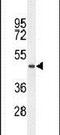 Transmembrane Protein 229A antibody, PA5-24405, Invitrogen Antibodies, Western Blot image 