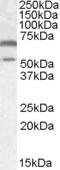 Calcium/Calmodulin Dependent Protein Kinase II Alpha antibody, EB09376, Everest Biotech, Western Blot image 