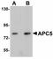 Anaphase Promoting Complex Subunit 5 antibody, orb89871, Biorbyt, Western Blot image 