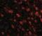 Tau Tubulin Kinase 1 antibody, NBP1-76989, Novus Biologicals, Immunofluorescence image 