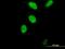 Forkhead Box M1 antibody, H00002305-M05, Novus Biologicals, Immunofluorescence image 