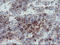 Myosin Light Chain 7 antibody, LS-C175166, Lifespan Biosciences, Immunohistochemistry paraffin image 