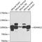 ADAM Metallopeptidase Domain 12 antibody, 23-294, ProSci, Western Blot image 