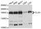 TLR4 Interactor With Leucine Rich Repeats antibody, PA5-76114, Invitrogen Antibodies, Western Blot image 