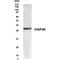 Coagulation Factor VIII Associated 3 antibody, GTX70399, GeneTex, Western Blot image 