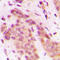 Cyclin Dependent Kinase 8 antibody, LS-C353939, Lifespan Biosciences, Immunohistochemistry paraffin image 