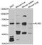 5-aminolevulinate synthase, erythroid-specific, mitochondrial antibody, abx005002, Abbexa, Western Blot image 