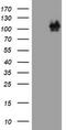 Catenin Delta 1 antibody, LS-C175501, Lifespan Biosciences, Western Blot image 