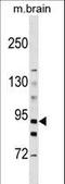 Hexokinase 3 antibody, LS-C101269, Lifespan Biosciences, Western Blot image 