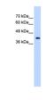 ST6 N-Acetylgalactosaminide Alpha-2,6-Sialyltransferase 5 antibody, orb325533, Biorbyt, Western Blot image 