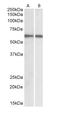 Interferon Regulatory Factor 5 antibody, LS-C20170, Lifespan Biosciences, Western Blot image 