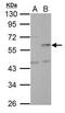 NUF2 Component Of NDC80 Kinetochore Complex antibody, PA5-22130, Invitrogen Antibodies, Western Blot image 