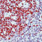 KI-67 antibody, LS-C88661, Lifespan Biosciences, Immunohistochemistry paraffin image 