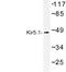 Inward rectifier potassium channel 16 antibody, LS-B13216, Lifespan Biosciences, Western Blot image 