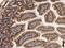 Gremlin-1 antibody, GTX01385, GeneTex, Immunohistochemistry paraffin image 