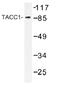 Transforming Acidic Coiled-Coil Containing Protein 1 antibody, AP01228PU-N, Origene, Western Blot image 