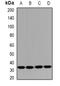 HUS1 Checkpoint Clamp Component B antibody, abx225226, Abbexa, Western Blot image 