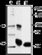 Transient Receptor Potential Cation Channel Subfamily V Member 2 antibody, GTX16610, GeneTex, Immunoprecipitation image 