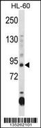 DNA Methyltransferase 3 Alpha antibody, 58-155, ProSci, Western Blot image 