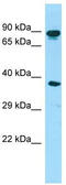 Hook Microtubule Tethering Protein 3 antibody, TA337953, Origene, Western Blot image 