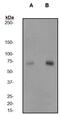 Protein Kinase C Zeta antibody, ab62372, Abcam, Western Blot image 
