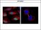 Baculoviral IAP Repeat Containing 5 antibody, GTX100441, GeneTex, Immunocytochemistry image 