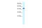 REST corepressor 3 antibody, 28-011, ProSci, Western Blot image 