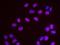 Sister chromatid cohesion protein PDS5 homolog A antibody, NB100-426, Novus Biologicals, Proximity Ligation Assay image 